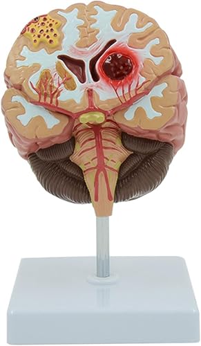 Modelos anatómicos Modelo de anatomía del cerebro humano Hemorragia cerebral para investigación científica en el aula y demostración de la enseñanza