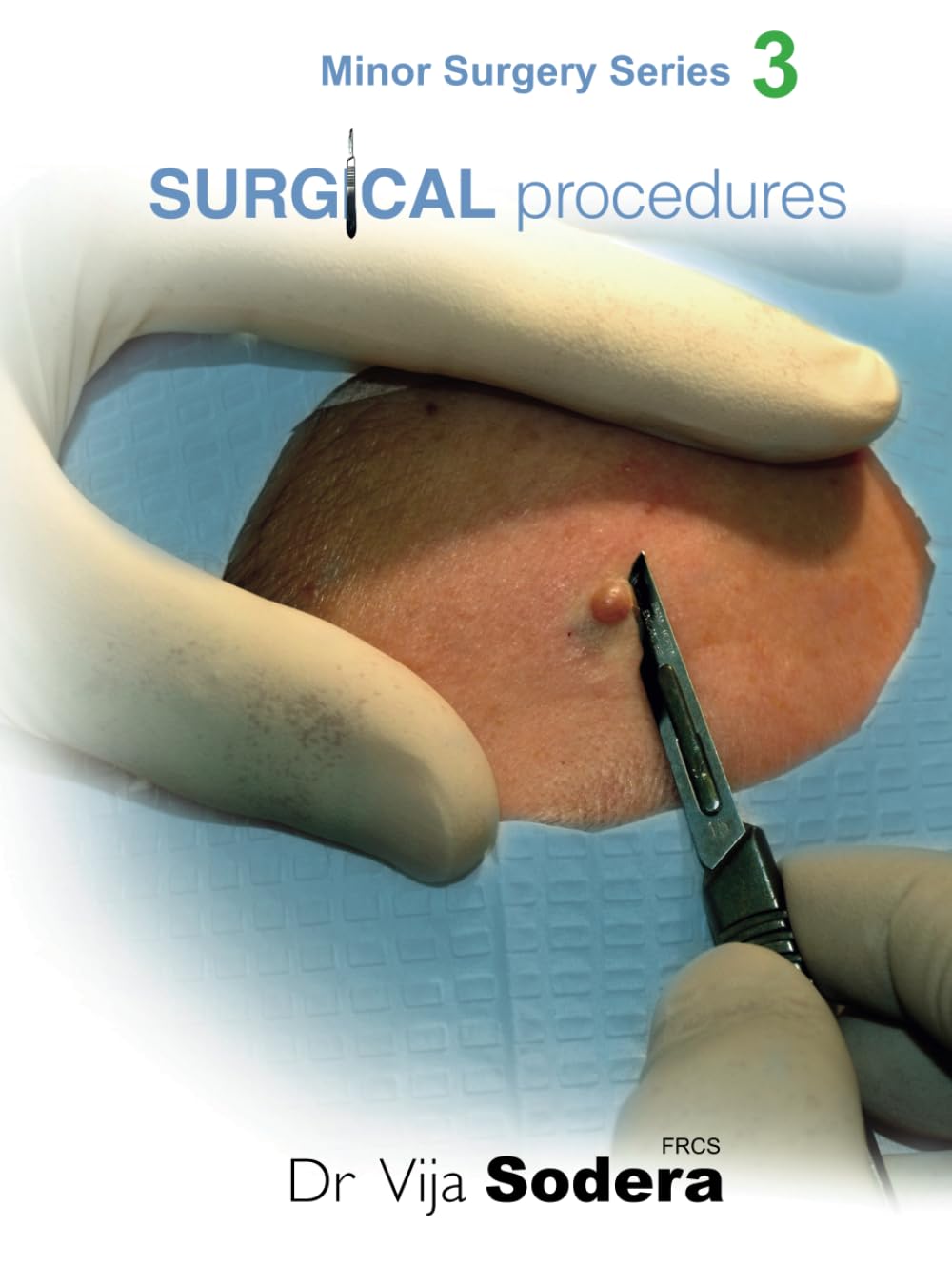 Surgical Procedures (Minor Surgery Series) by Dr Vija Sodera FRCS