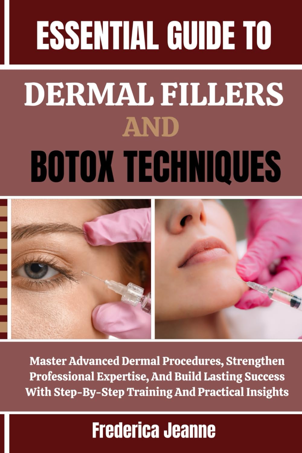 ESSENTIAL GUIDE TO DERMAL FILLERS AND BOTOX TECHNIQUES: Master Advanced Dermal Procedures, Strengthen Professional Expertise, And Build Lasting ... Step-By-Step Training And Practical Insights