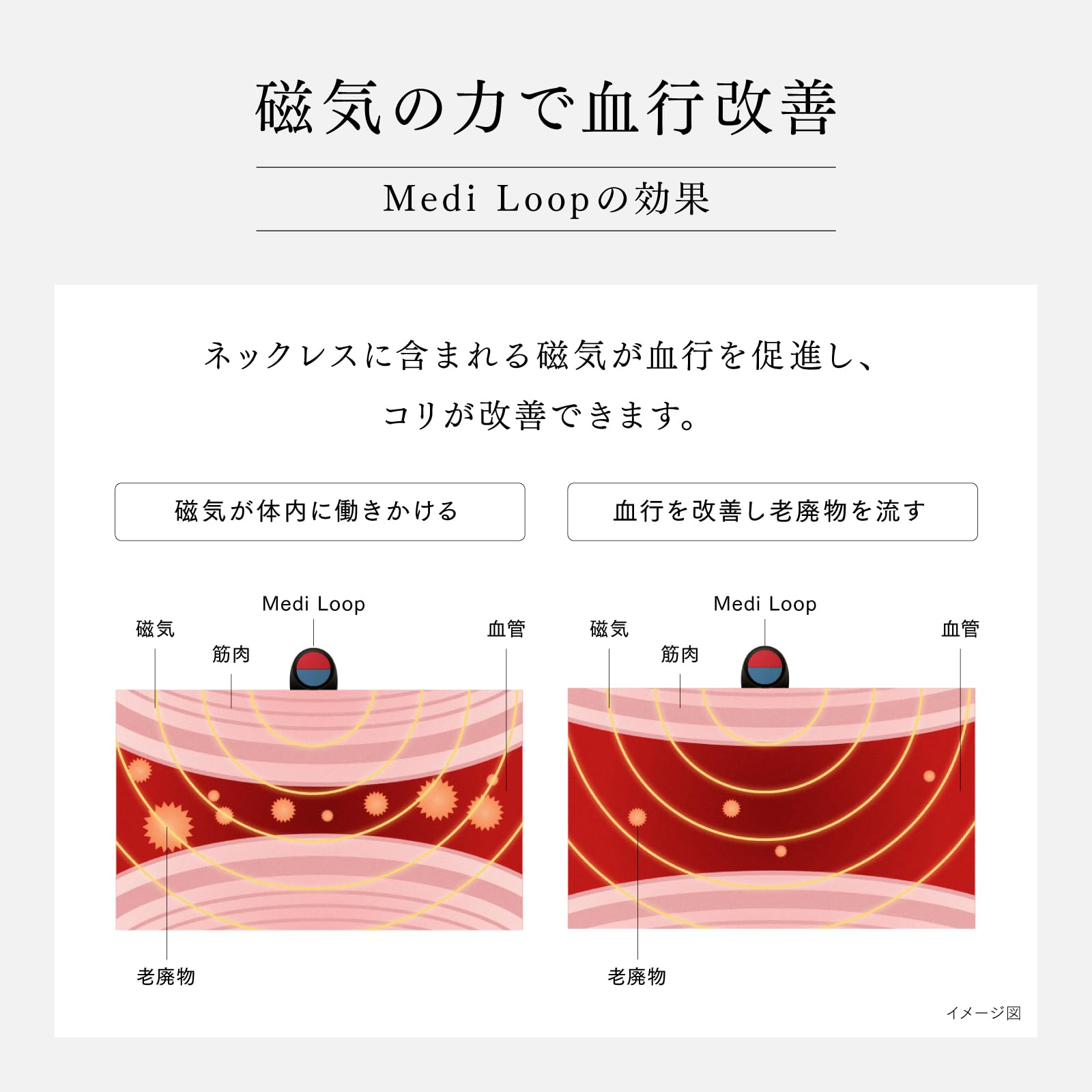 Amazon.co.jp: MYTREX Medi Loop マイトレックス メディループ 磁気