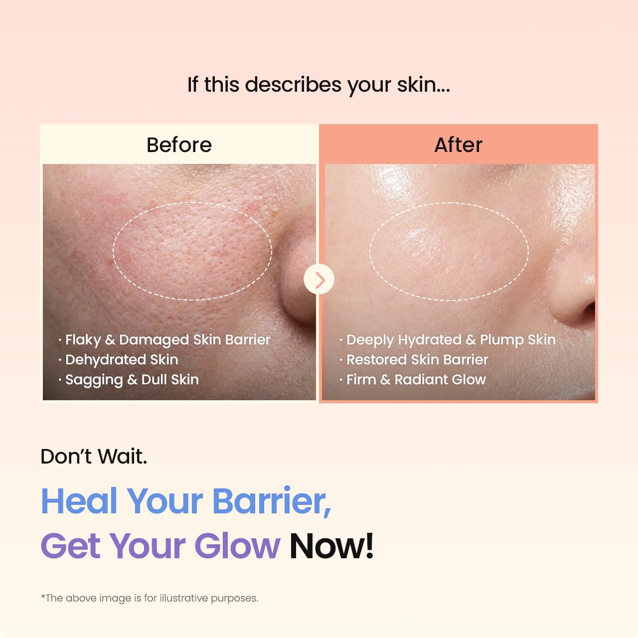 BIODANCE Barrier Rescue Duo: Caviar PDRN & Ceramide Panthenol Real Deep Overnight Gel Mask for Hydrating Plumping for Glass Skin, Korean Skin Care, Skin Care Set - Image 3