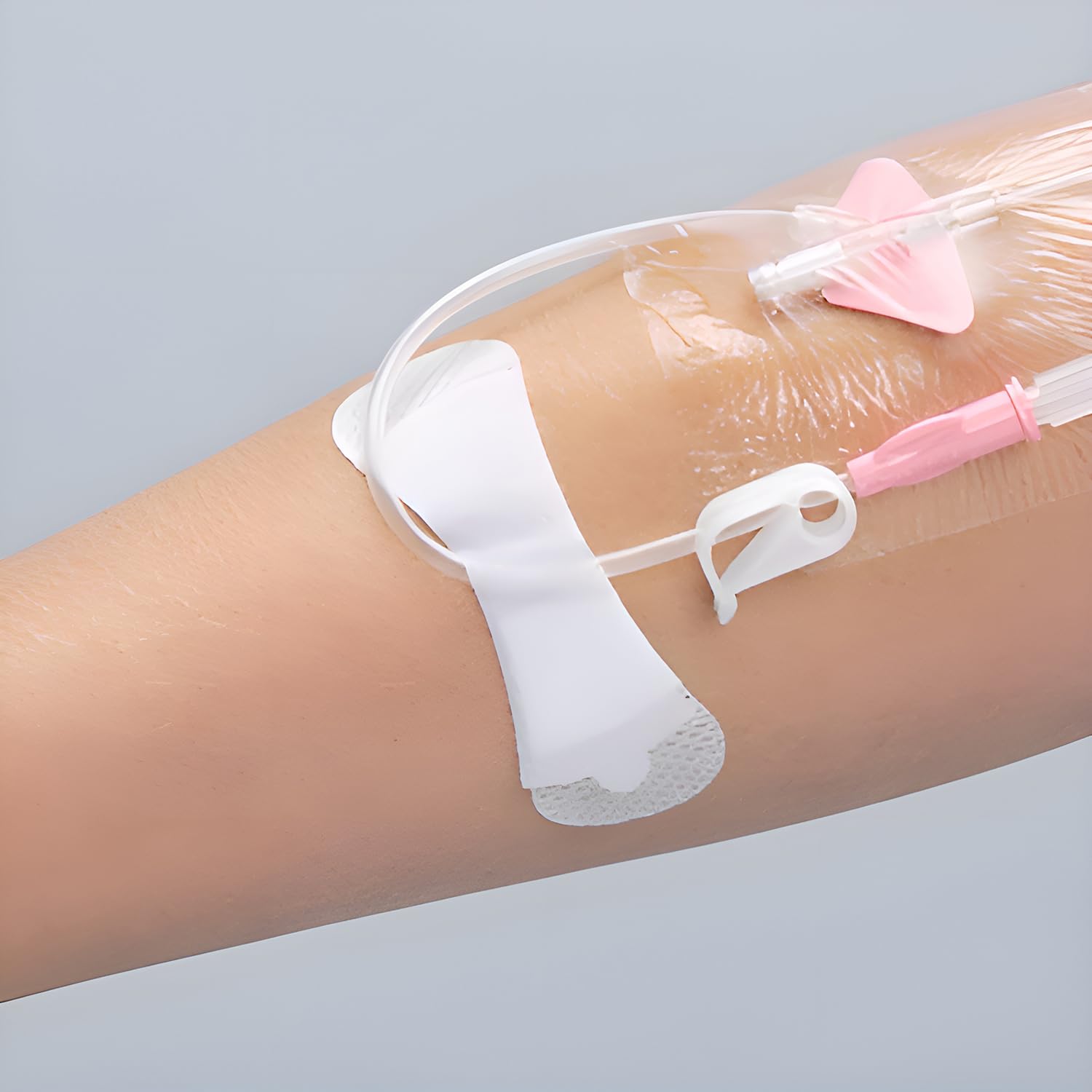 TIDI Products 3460L Grip-Lok Securement Device, Universal, Sterile, Individually Packaged, Large (Pack of 50)