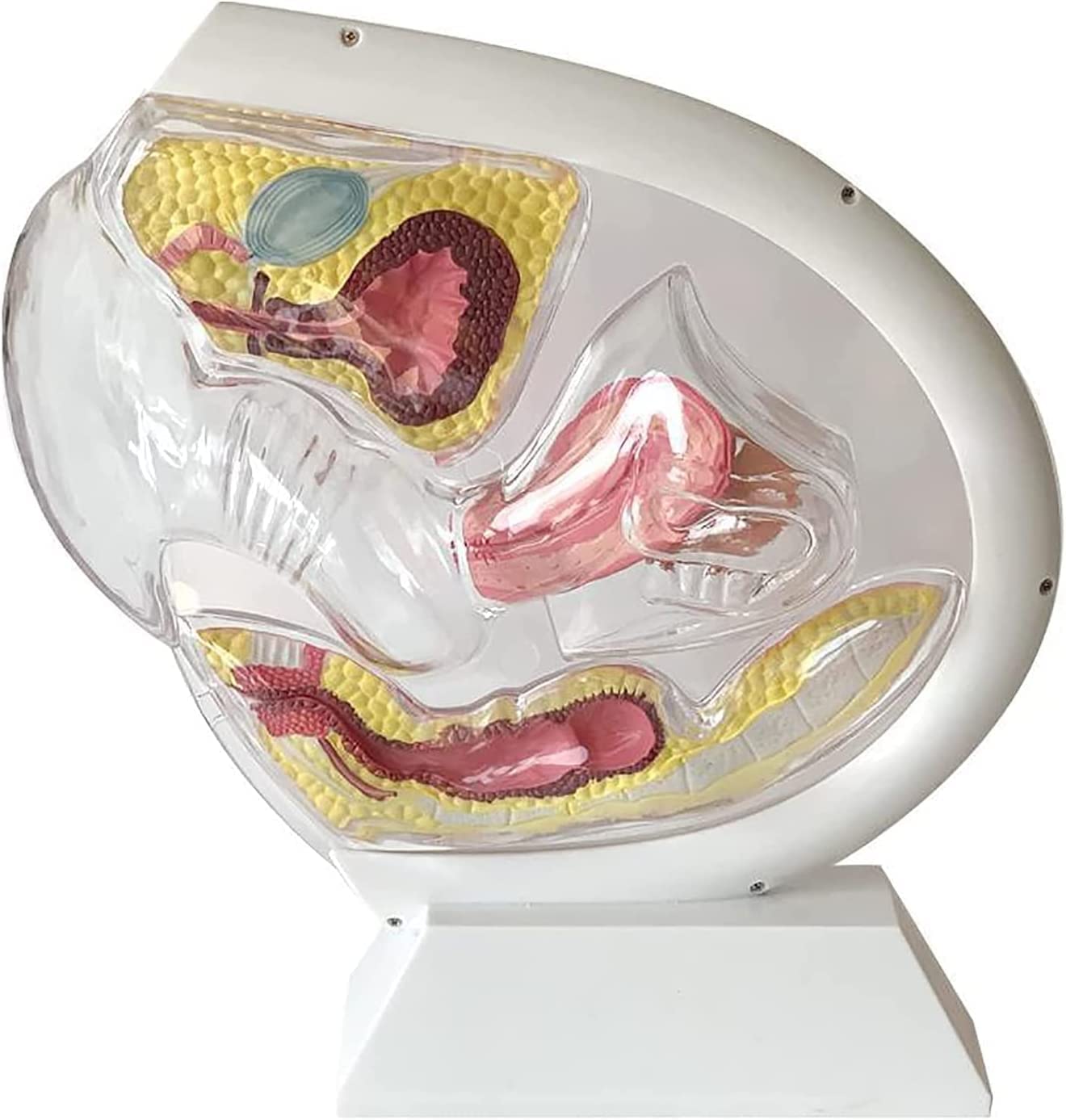 Transparentes Uterus-Modell Demonstration des Menstruationstassen-Verhütungslehrmodells Fortpflanzungsorgan Anatomisches Modell des Uterinen Fortpflanzungssystems des Becken-Eierstocks