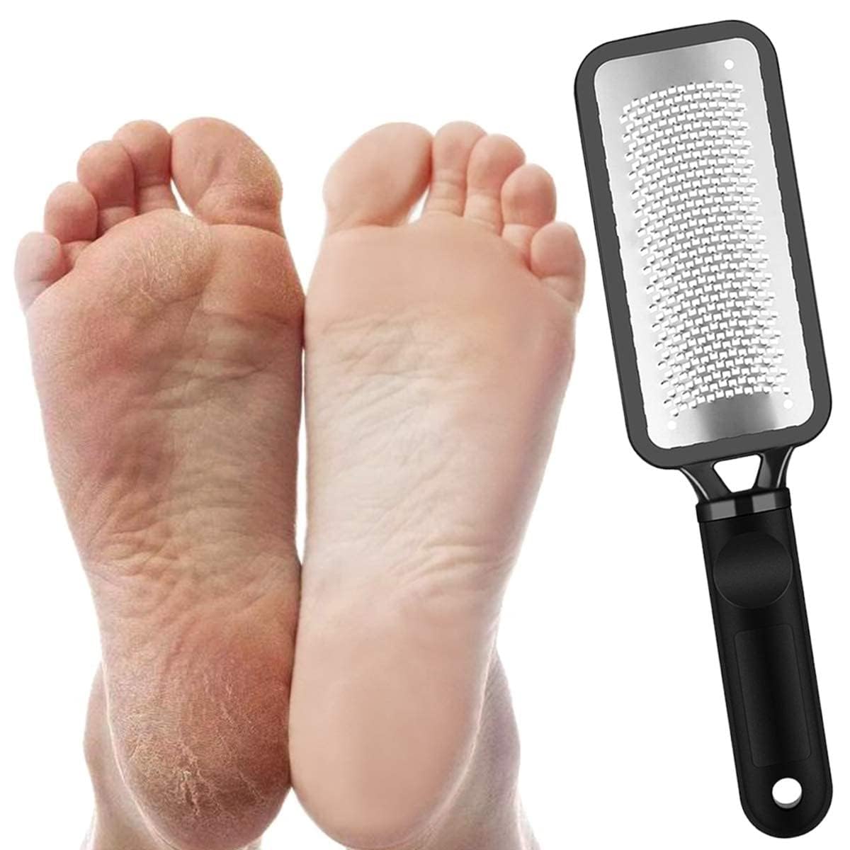 Leg, Heel & Foot Scrubber for Dead Skin - Very Sharp & Big (11 * 3 inch) - Pedicure & Feet Scrub Tools, Foot Scraper Cleaner & Filer, Callus Remover For Cracked Heels (Metal)-image-19
