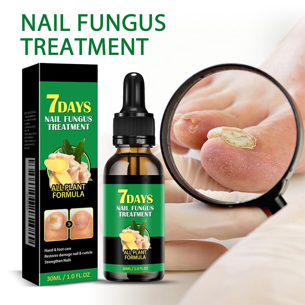 Siero per Unghie allo Zenzero da 30 ml, Siero per Unghie Rinforzante e Riparatore, Olio per Unghie allo Zenzero per Rafforzare le Unghie