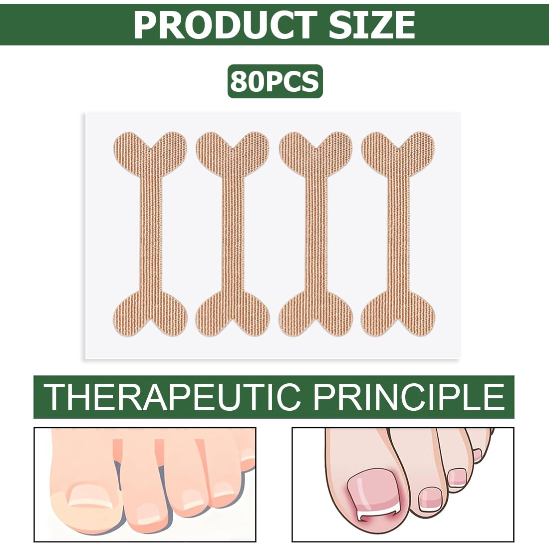 80 Piezas Korrección de Uñas Encarnadas, Parche Corrector de Uñas de los Pies,Parche de Corrección de Uña Encarnada Elástico, Pegatinas de Uñas Encarnadas, para Mujeres y Hombres