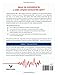 Getting Acquainted With Wide Complex Tachycardias: A Workbook for the Electrocardiographically Confused!