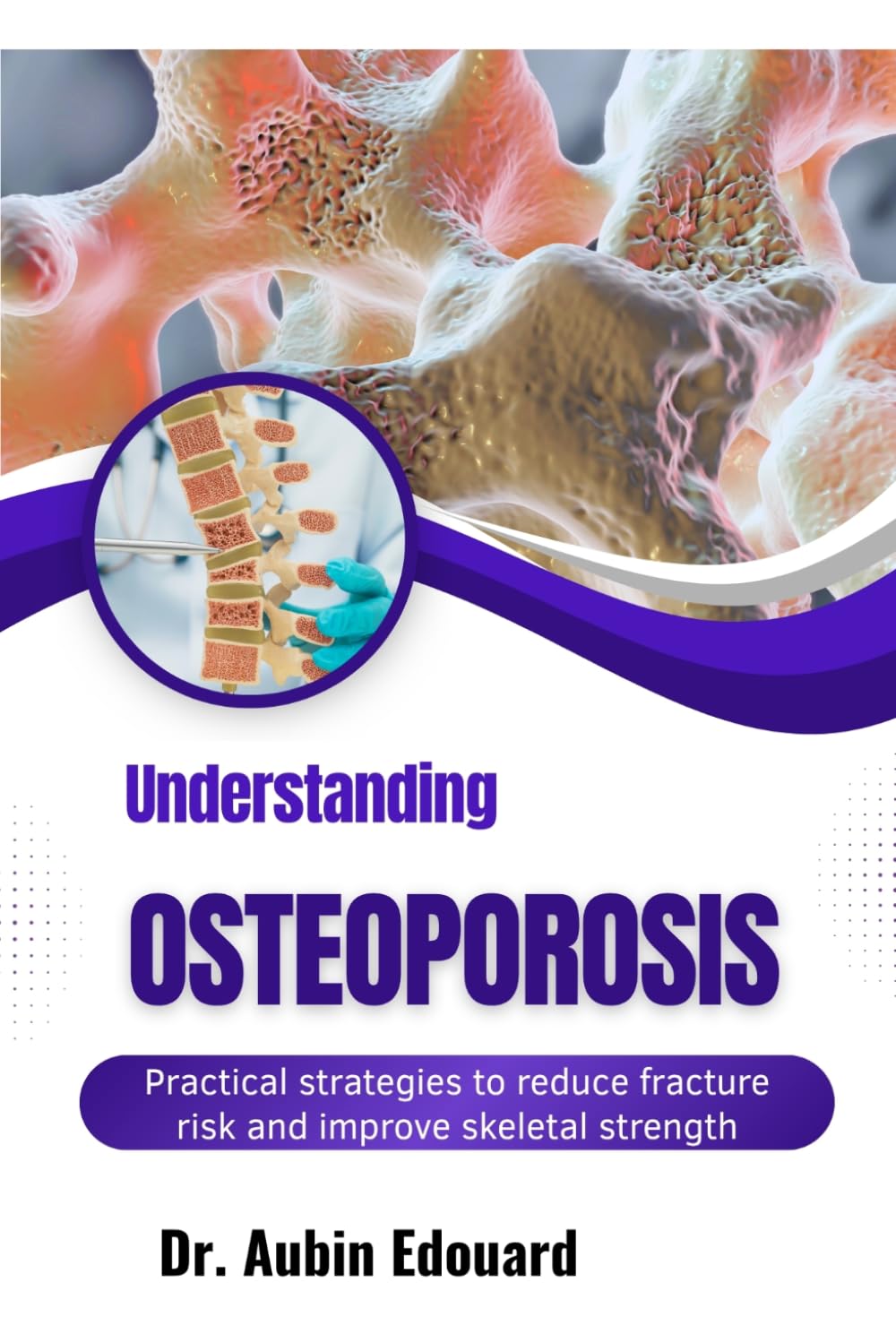 Understanding Osteoporosis: Practical strategies to reduce fracture risk and improve skeletal strength