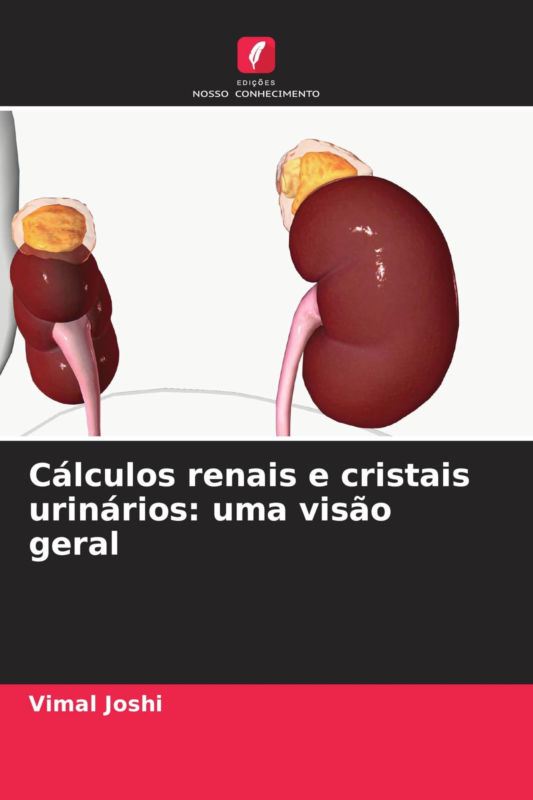 Cálculos renais e cristais urinários: uma visão geral