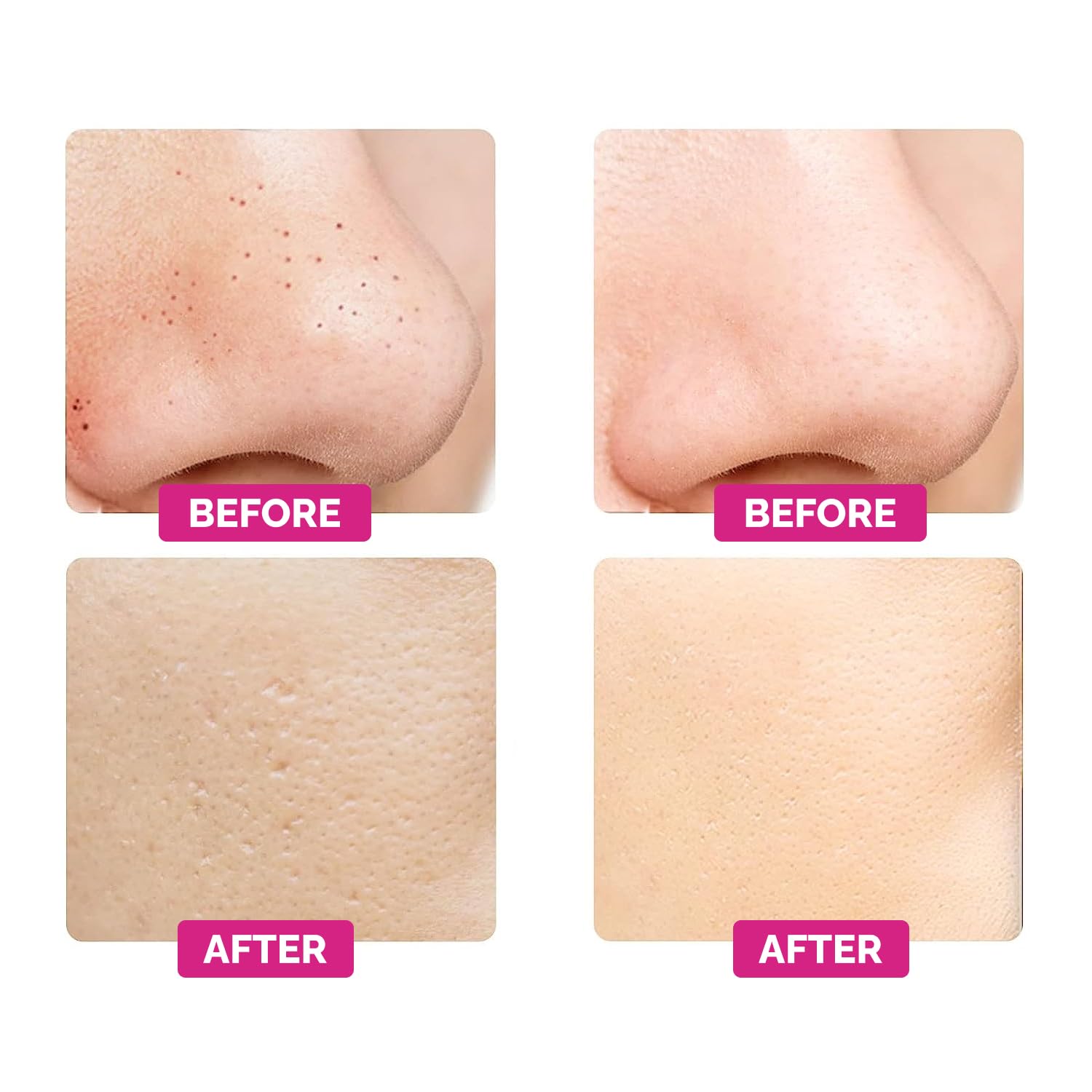 GESS Dispositivo EMS de Masaje & Peeling Ultrasónico – Limpiador de Poros & Papada, 3 Modos Reafirmantes, Micromasaje Ultrasónico & Miostimulación, Limpieza Profunda & Cuidado Facial Efectivo