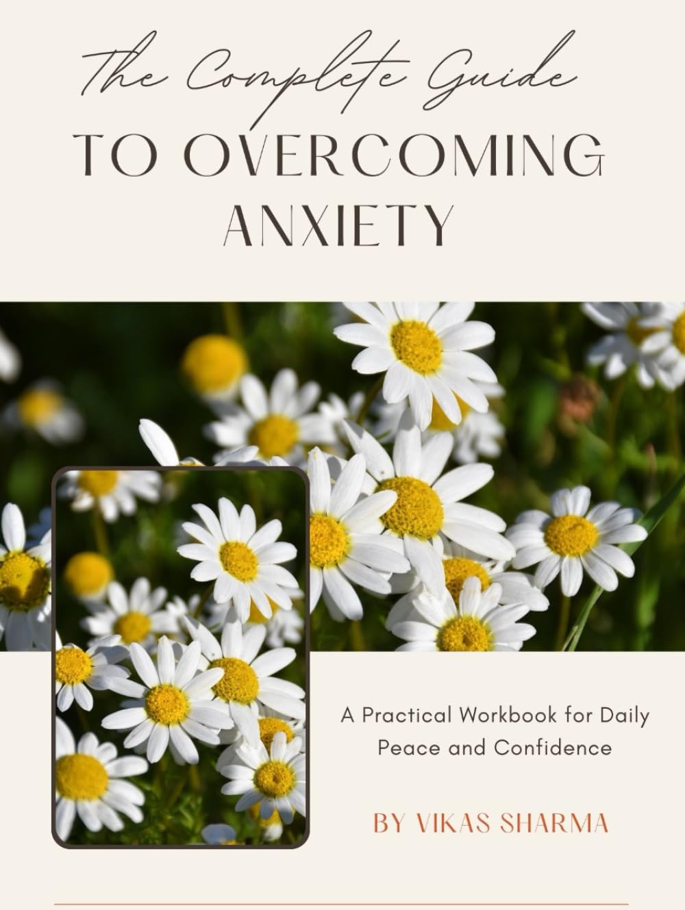 The Complete Guide to Overcoming Anxiety: Practical Workbooks, Stories, and CBT Strategies for Daily Calm, Confidence, and Stress Relief