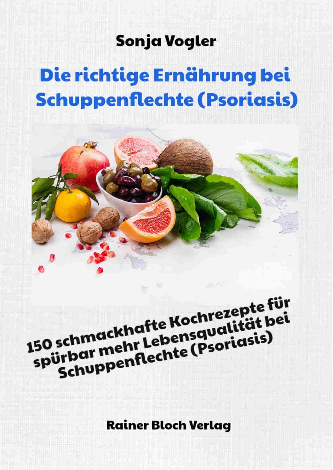 Die richtige Ernährung bei Schuppenflechte: 150 schmackhafte Kochrezepte – Psoriasis Buch