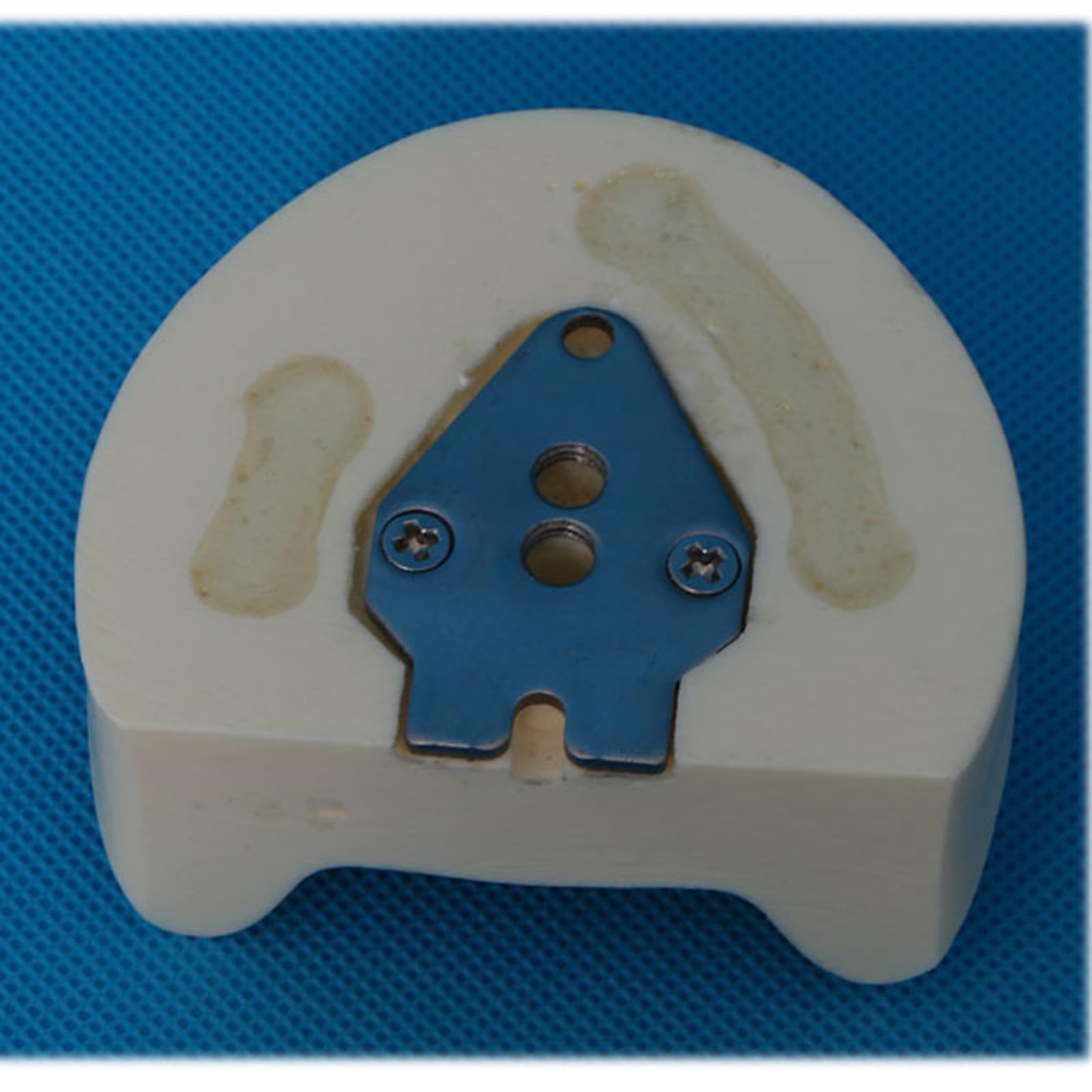 Modello di impianto Dentale - Modello di impianto mandibolare Medico e odontoiatrico - per Studio didattico Displaymedical Model,A5-8cm