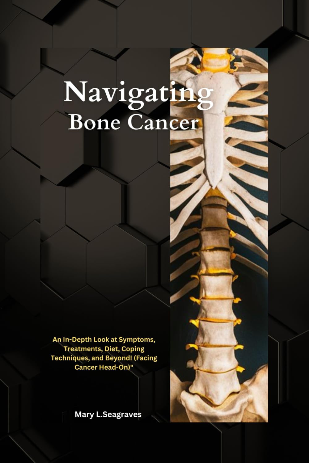 Navigating Bone Cancer: : An In-Depth Look at Symptoms, Treatments, Diet, Coping Techniques, and Beyond! (Facing Cancer Head-On)": 1 (On This Facing Cancer Series)