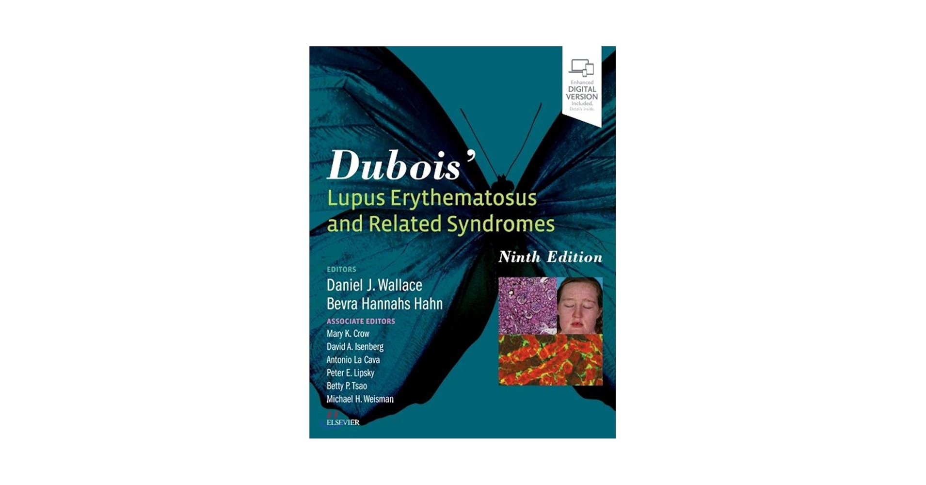 語学+参考書 Dubois' Lupus Erythematosus and Related Syndromes Dubois' Lupus Erythematosus and Related Syndromes: Expert