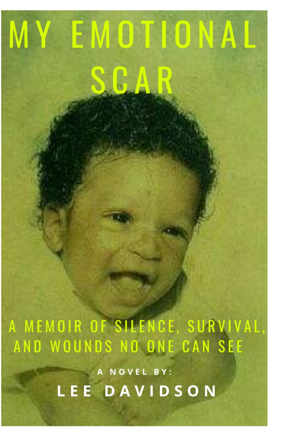 My Emotional Scar: A Memoir of Silence, Survival, and the Wounds No One Could See