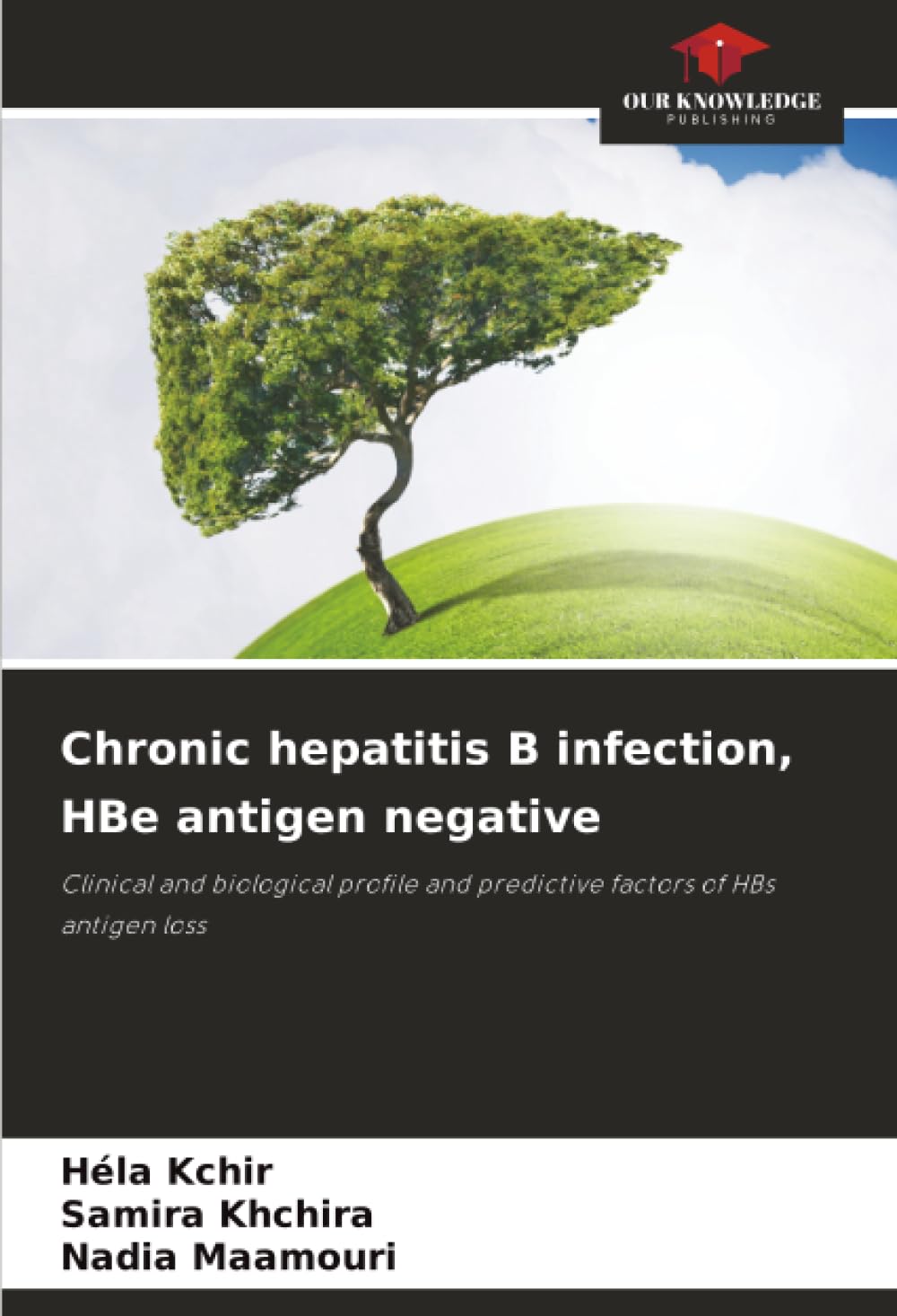 Chronic hepatitis B infection, HBe antigen negative: Clinical and biological profile and predictive factors of HBs antigen loss