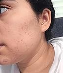 Review Image by Anita sosa Anita sosa