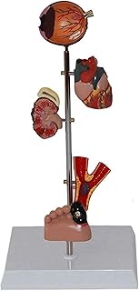 Study Model Diabetes Organ Model -Medical Anatomical Diabetes Model - Removable Human Organ Anatomical Model Human Anatomy Science Models - for Medical Educational Training Aid SaiFei