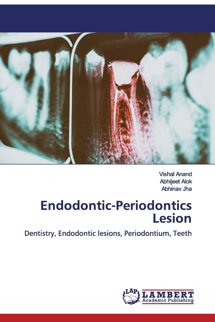 Buy EndodonticPeriodontics Lesion Dentistry, Endodontic lesions