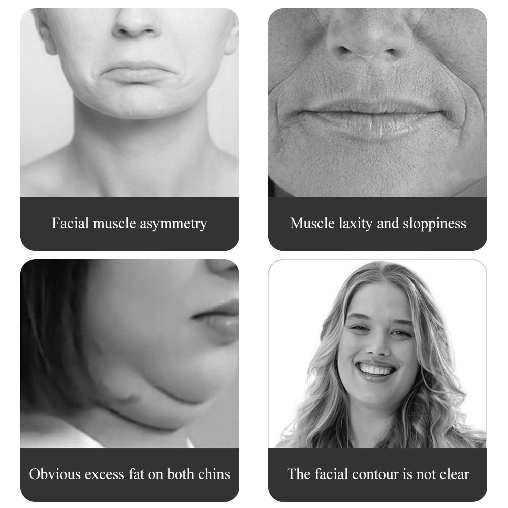 MAOYING Masajeador Eléctrico Moldeador Facial en V + 2 Pares de Almohadillas de Gel, Dispositivo Anti-Arrugas Cuello & Reafirmante, Tecnología EMS de Microcorriente Mejorada, 6 Modos Reafirmantes