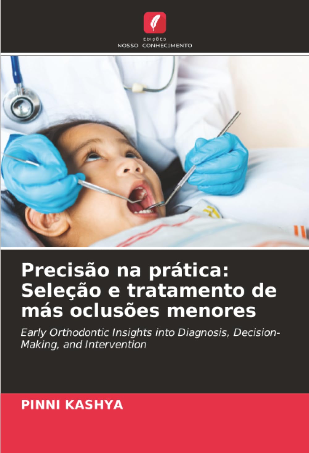 Precisão na prática: Seleção e tratamento de más oclusões menores: Early Orthodontic Insights into Diagnosis, Decision-Making, and Intervention