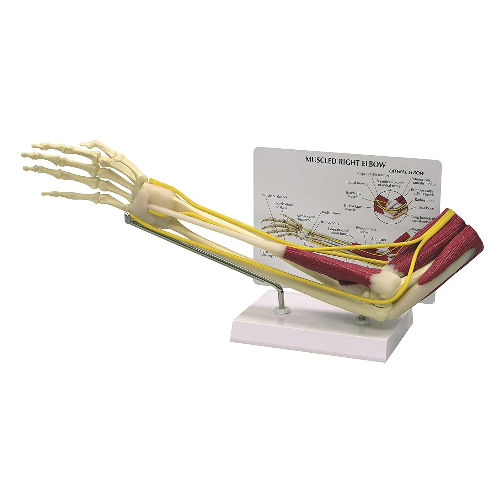 AmhuuiMuscled Elbow Joint Model, Elbow Joint W/Muscles Model, Human Arm Anatomical Muscle Model Anatomy Arm Model for Doctors Office Educational Tool, GPI Anatomicals