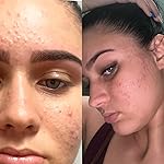 Review Image by Frank Frank