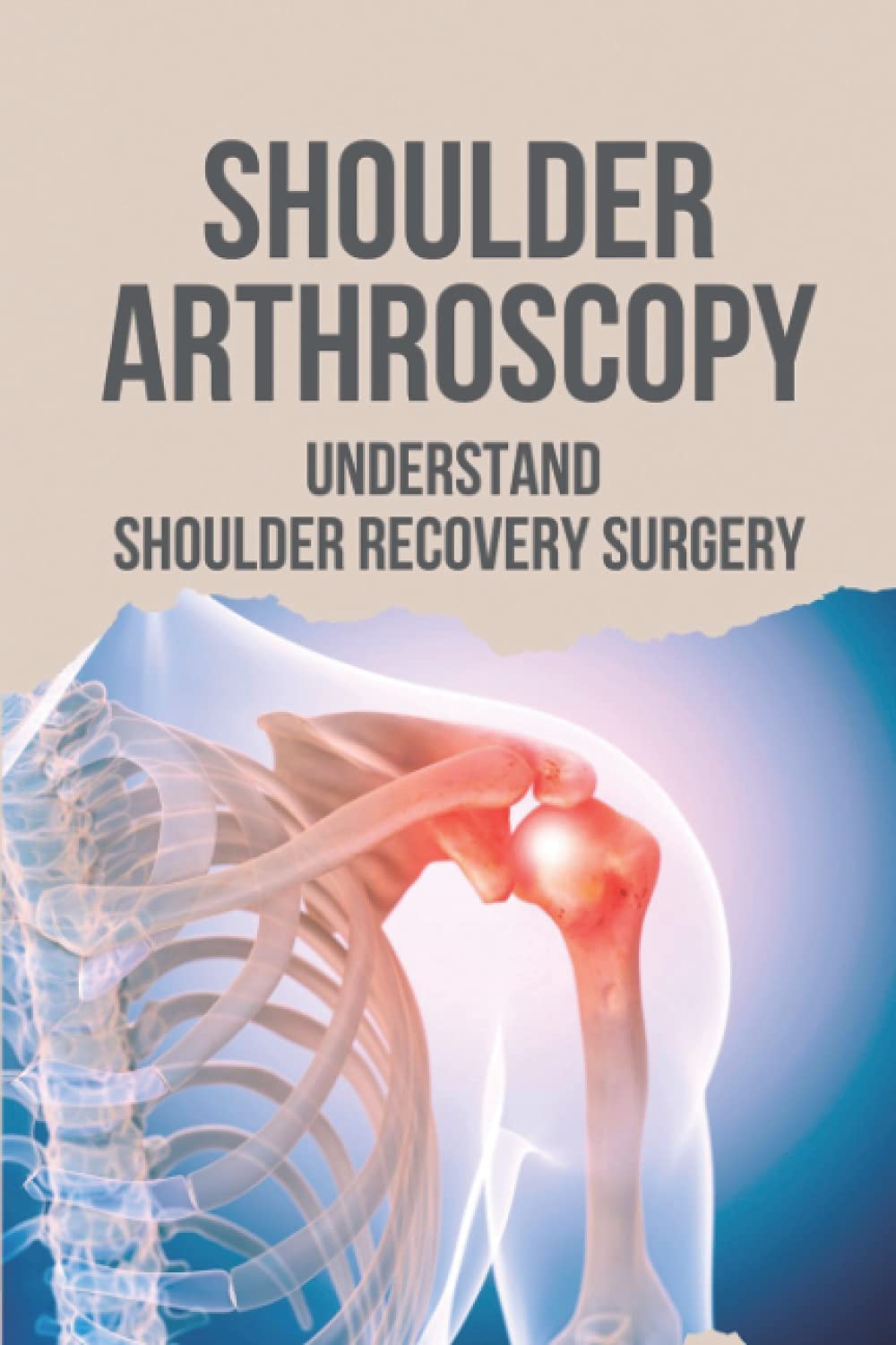 Shoulder Arthroscopy: Understand Shoulder Recovery Surgery: Shoulder Surgery Rehibilitation