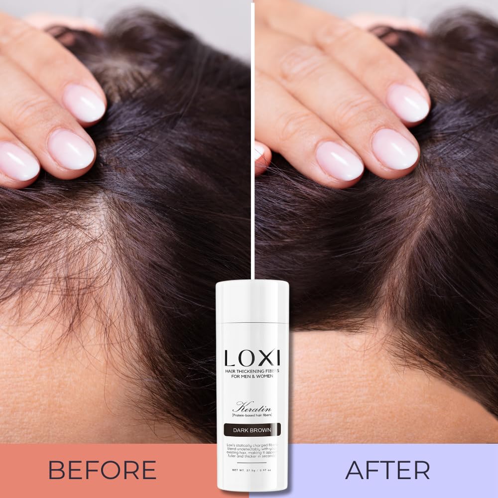 LOXI Hair Building Fibers (27.5g) | Fill In Fine, Thinning & Balding Hair for an Instantly Thicker & Fuller Look | Premium Keratin Formula | 5 Shades for Men & Women (Medium Brown).