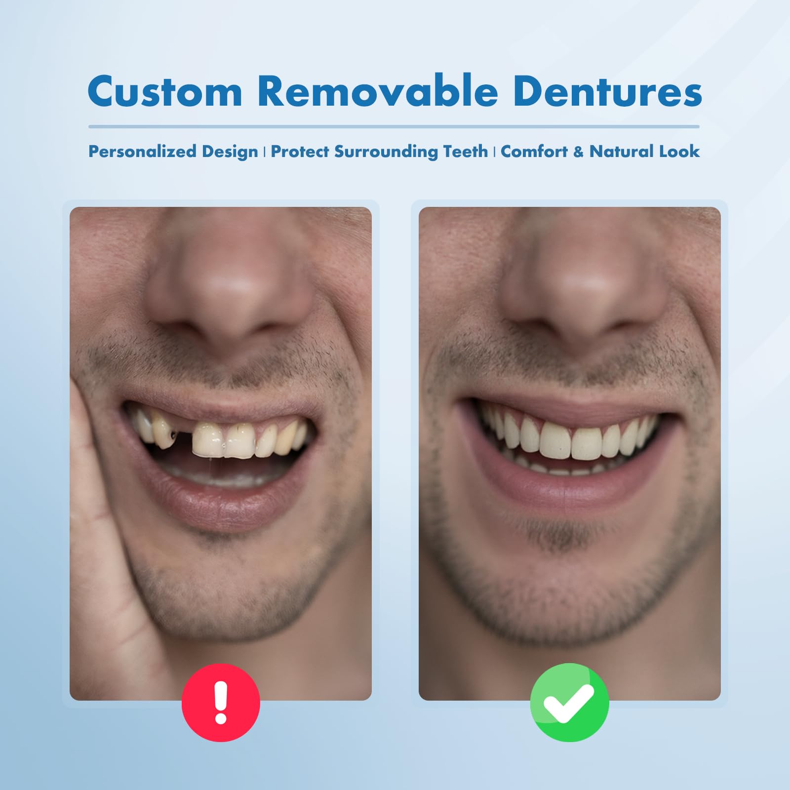 Custom Removable Dentures – Personalized Partial Denture Set for Tooth Replacement | 1–Multi-Tooth Coverage with Storage Case | Comfortable Wear for teeth (6 Teeth)