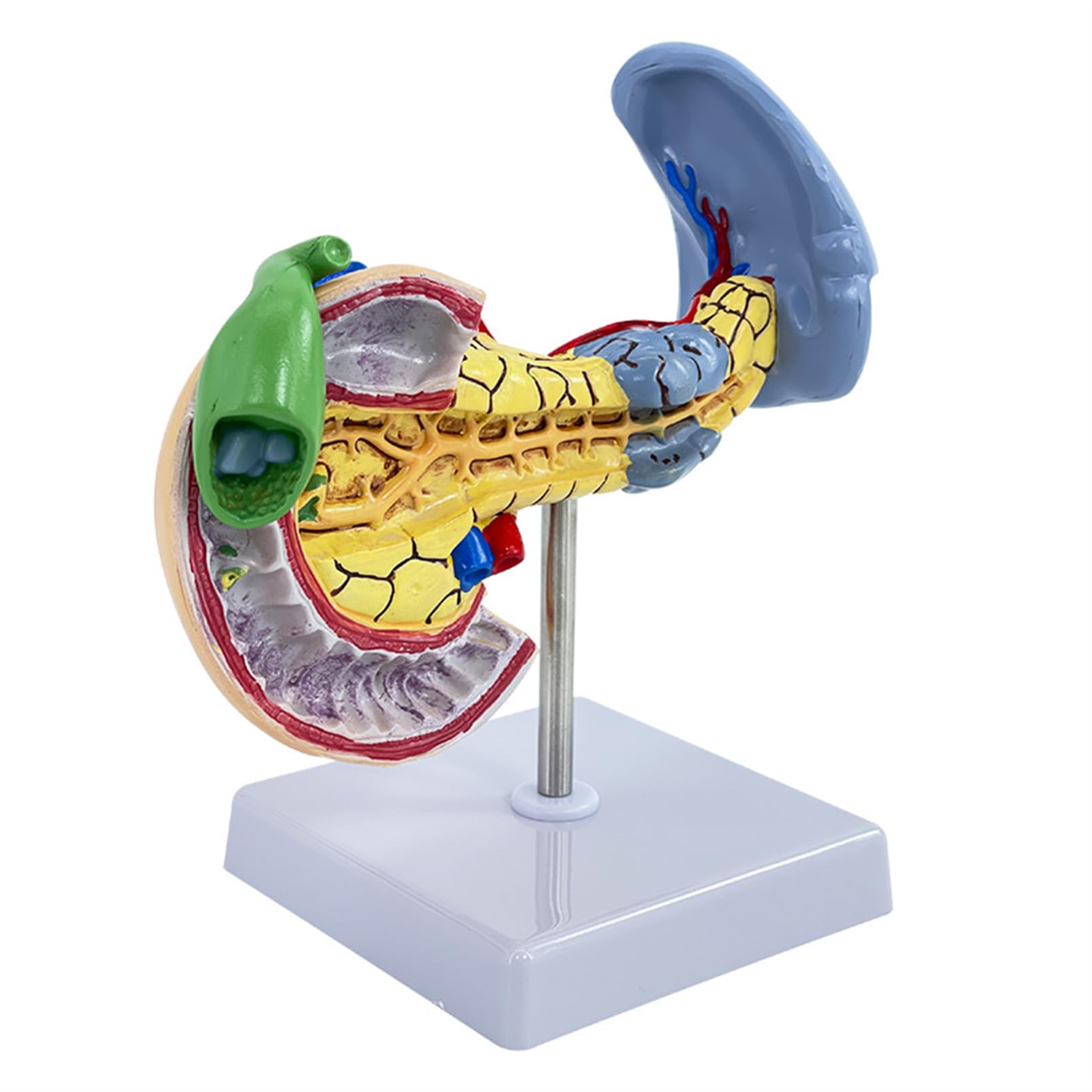 Modèle anatomique pancréas pathologique rate vésicule duodénum AMITD pour étude médicale
