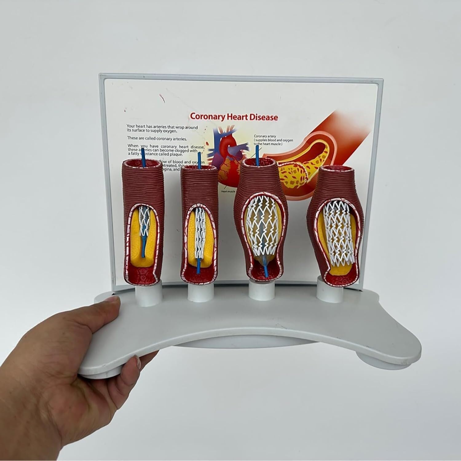 model anatomiczny, Model nauczania okluzji naczyń krwionośnych