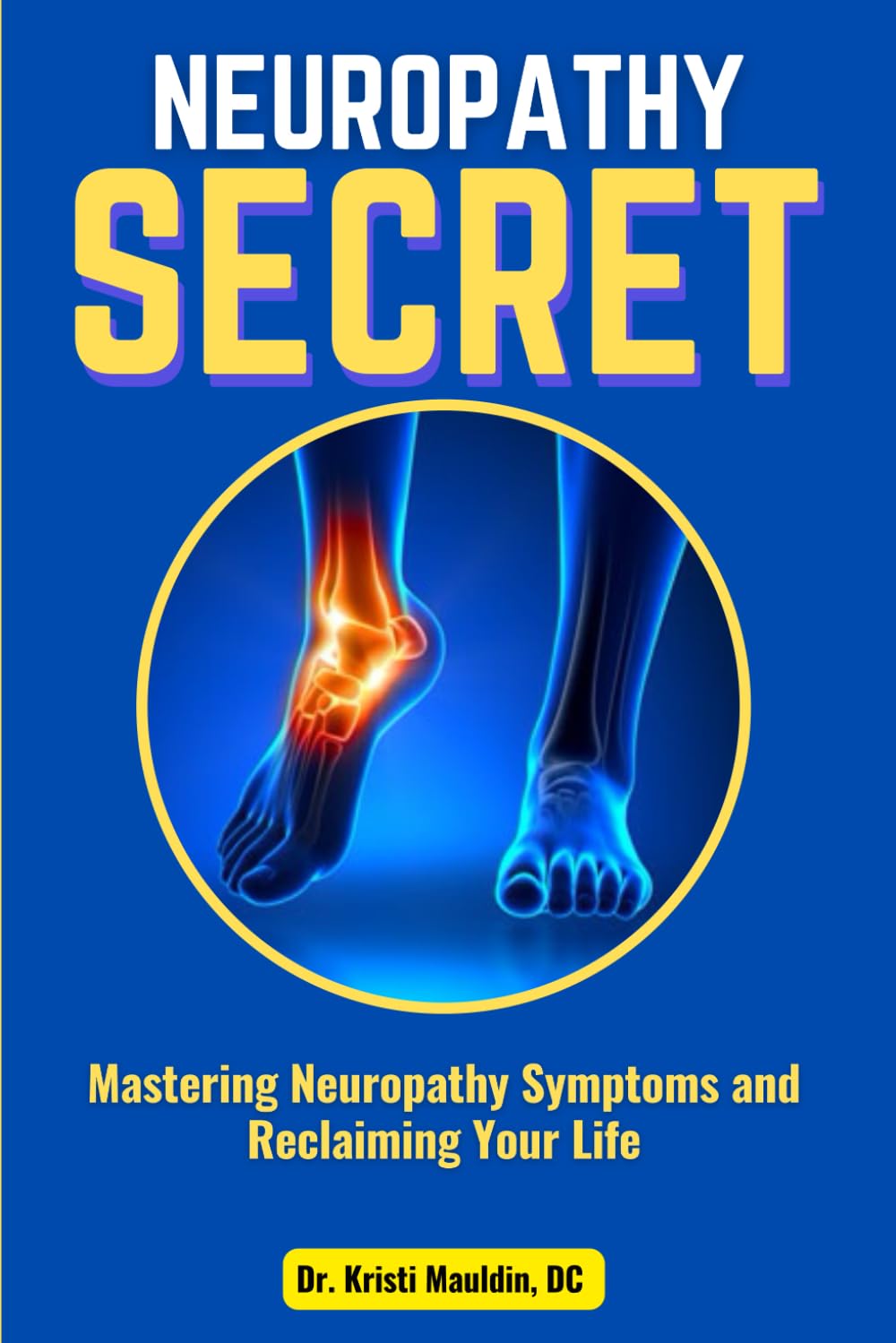 Neuropathy Secret: Mastering Neuropathy Symptoms and Reclaiming Your Life