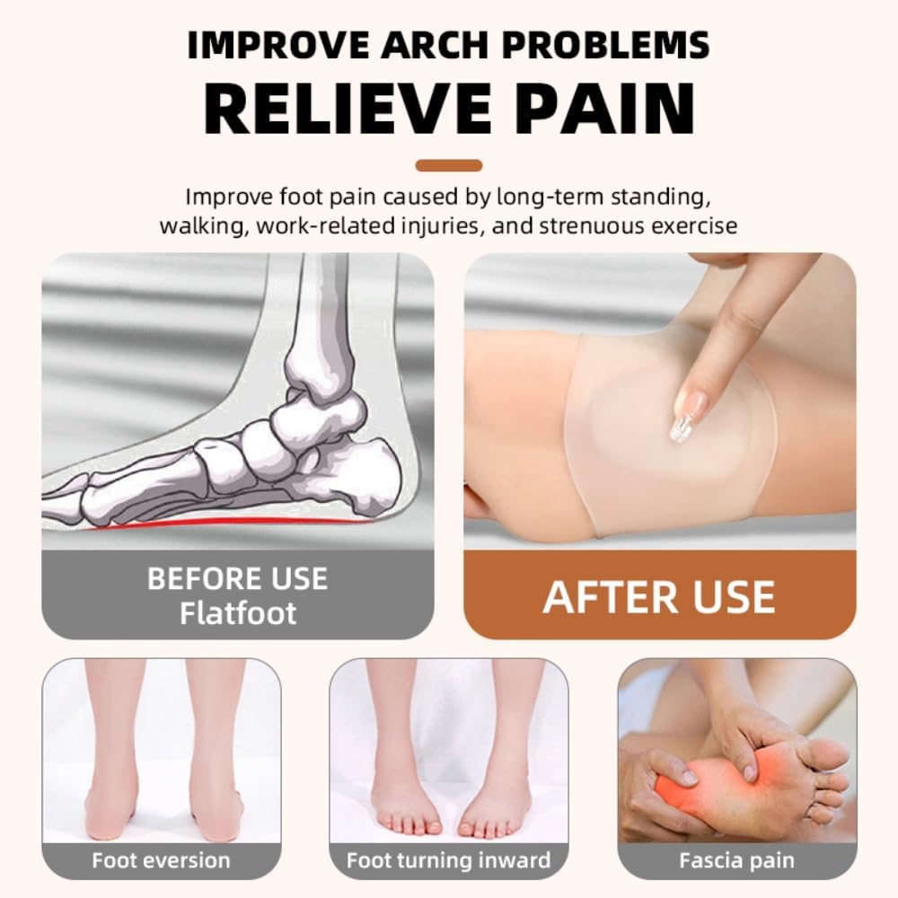 XINIFOOT Arch Support Sleeves - Orthotic Relief for Flat Feet & Arch Pain - Unisex Support for Men and Women (Small, 2 Pairs) - Image 4