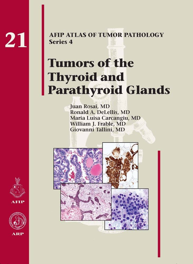 AFIP　Tumors of the Pancreas 【新品】 Tumors of the Pancreas (Afip Atlas of Tumor Pathology; 4th