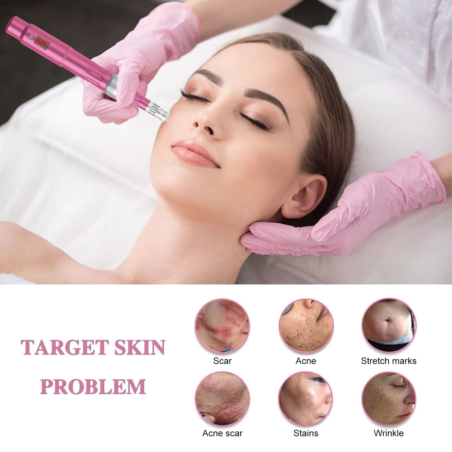 10 Pcs 36 Pin Agujas Dermapen,Dermapen Profesional, Micro Agujas de Reemplazo Sin dolor puntas cartucho Ranura Roscada para Antienvejecimiento Arrugas Rejuvenecimiento de la piel