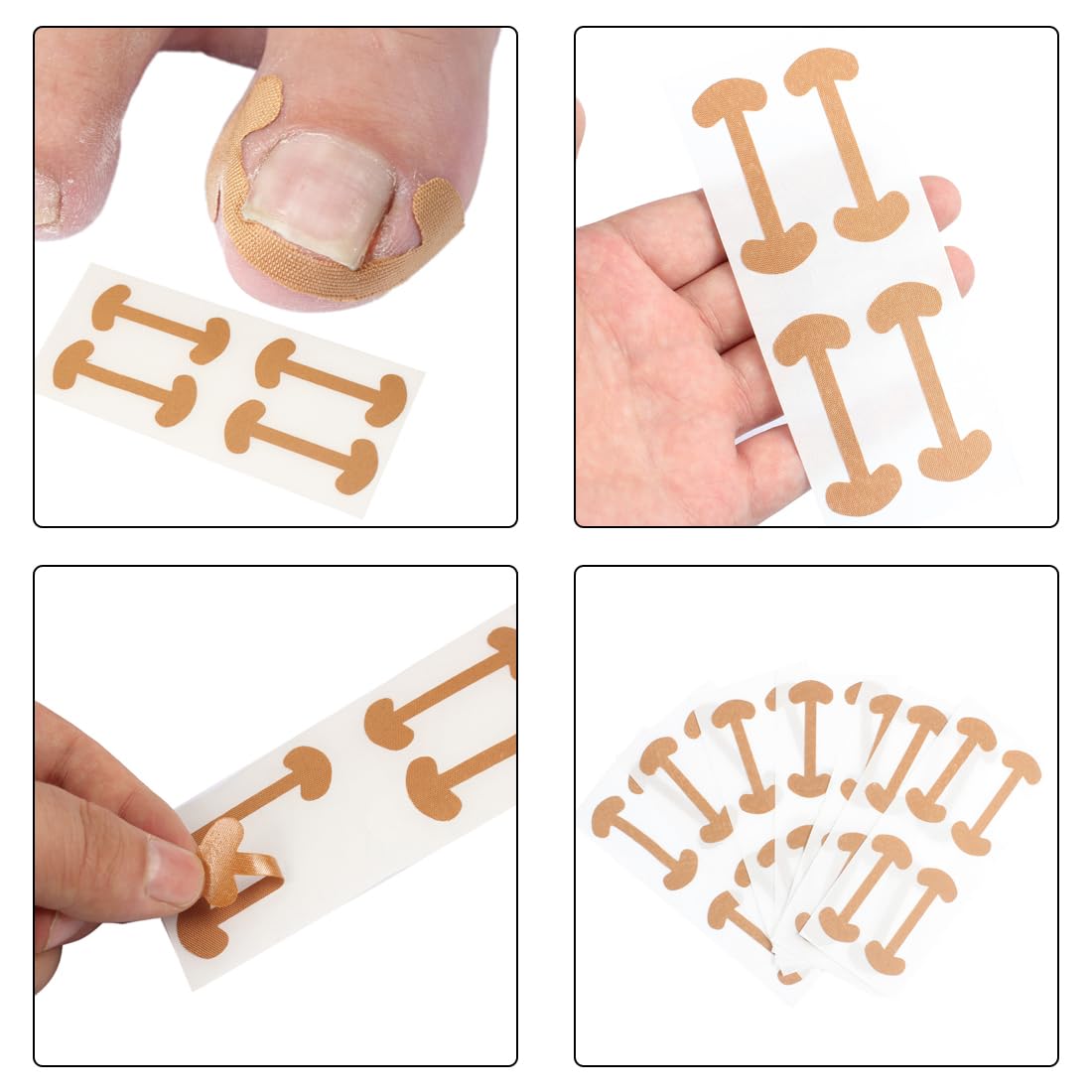 50 Foglio Correttore per Unghie Incarnite, Cerotti per Unghie, Unghia Incarnita Alluce, Unghie Incarnite Piedi, Strumenti per Pedicure, Cerotto per Unghia Incarnita
