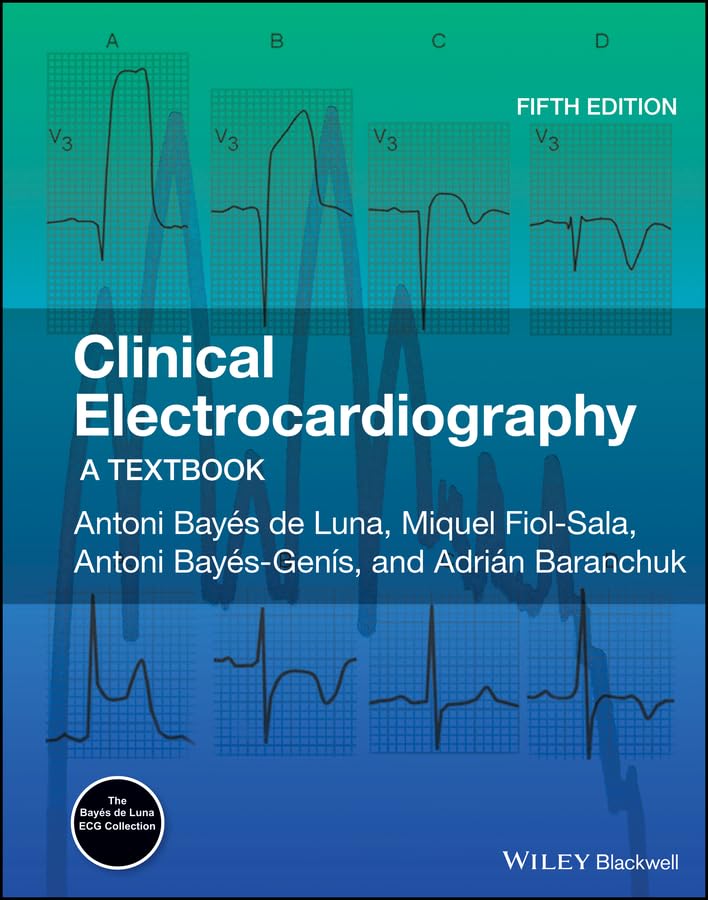 Clinical Electrocardiography: A Textbook