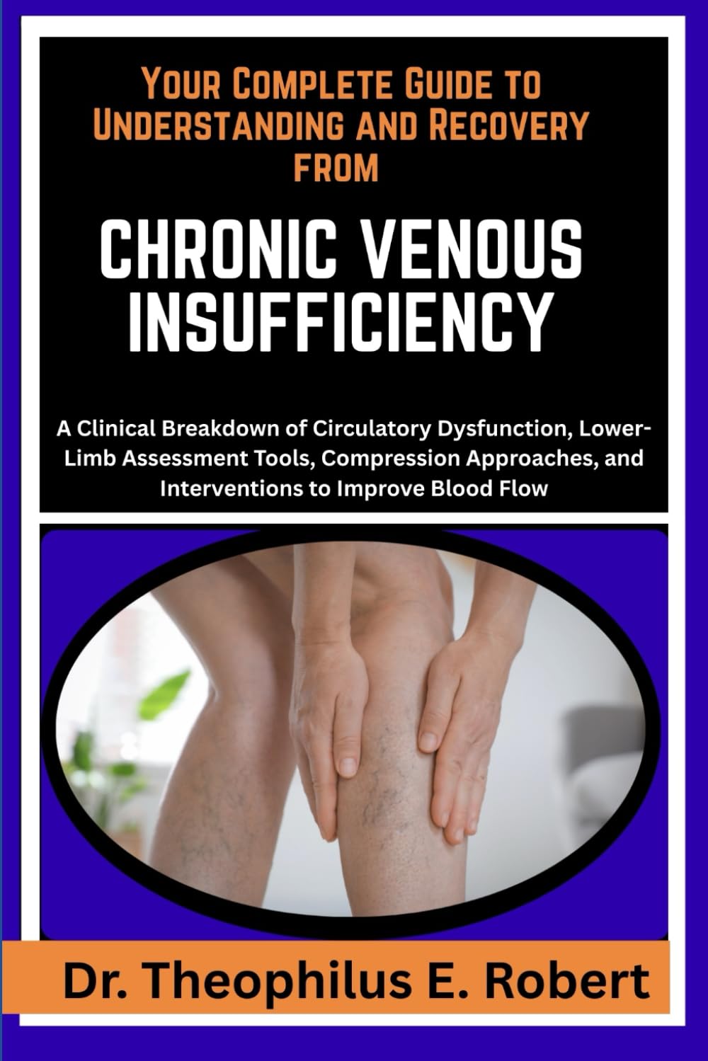YOUR COMPLETE GUIDE TO UNDERSTANDING AND RECOVERY FROM CHRONIC VENOUS INSUFFICIENCY: A Clinical Breakdown of Circulatory Dysfunction, Lower-Limb ... and Interventions to Improve Blood Flow