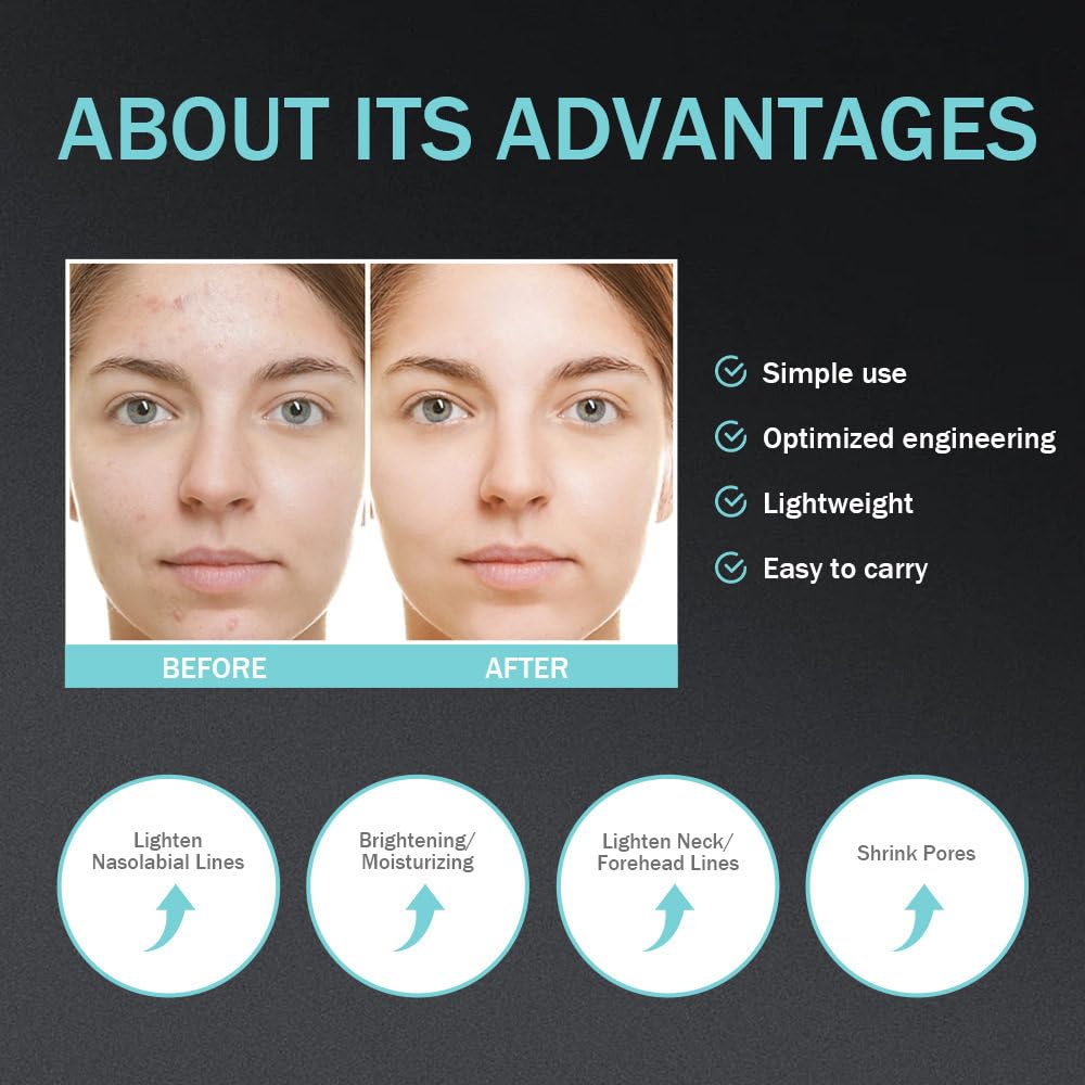 Hautpflegegerät – Gesichts-Glow-Booster, LED-Anti-Falten-Gerät, 5-Gang-Einstellung, Ausstrahlung, Elastizität, Maximierung Und Steigerung Der Hautpflegeaufnahme