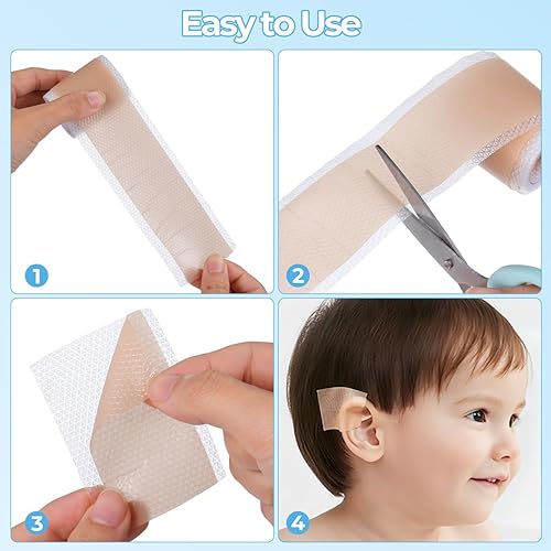 Miniatura 5 de 1 juego de parches de corrección de oído infantil Correctores estéticos de oídos para bebés recién nacidos para niños, bebés