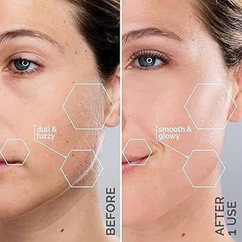 Maira sonic beauty Tーwin Amazon.com: Michael Todd Beauty Sonicsmooth Pro+ Dermaplane