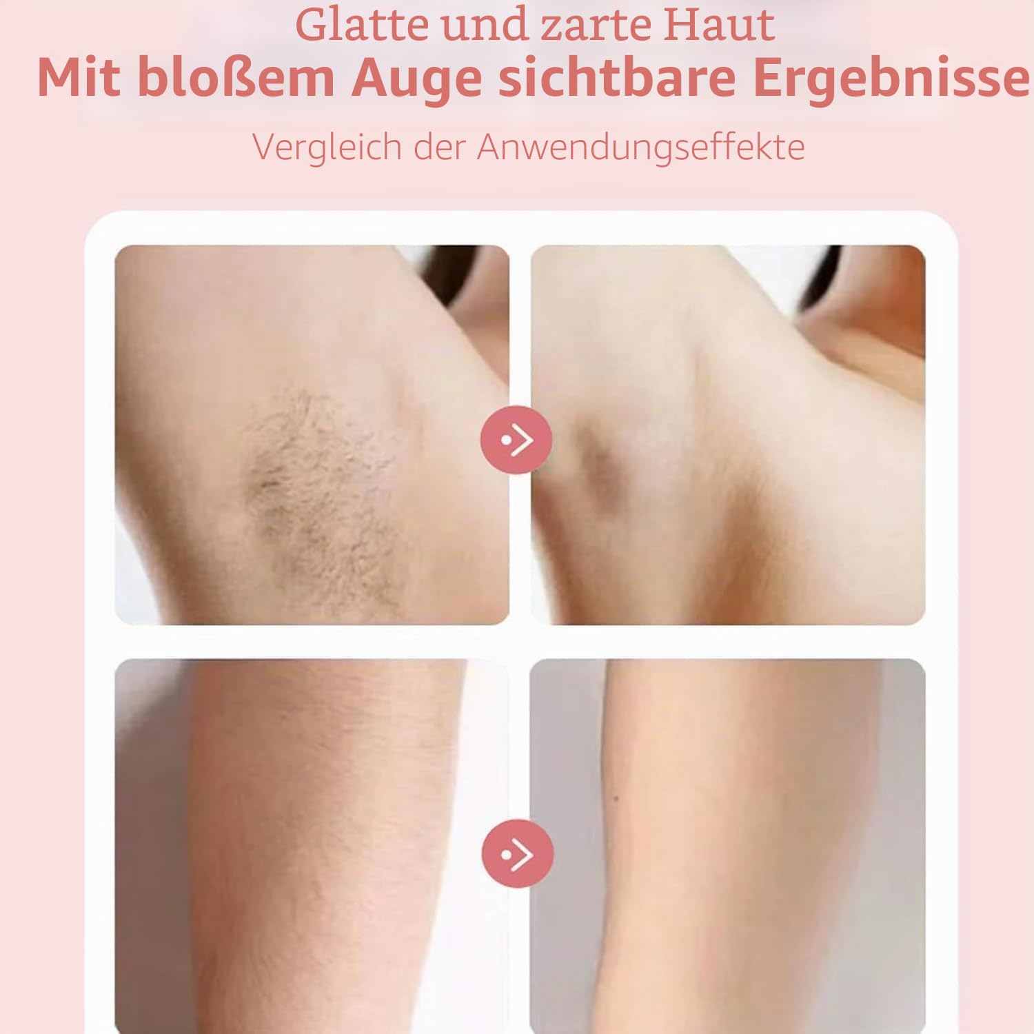 Sommer Starter Set, Rasierer - Für Seidig Glatte Haut, Rasierer Damen, Ipx7 Wasserdicht, Kabelloser USB Nass/Trocken Epilierer Für Gesicht Bikini Beine Arme (Pink)
