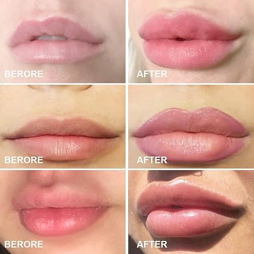 Miniatura 6 de Labios Potenciador Dispositivo Regordete Labios Silicona Forma de Pez Labios Plumper Labios Rellenar Labios Natural Pout Boca Herramienta Sexy Boca