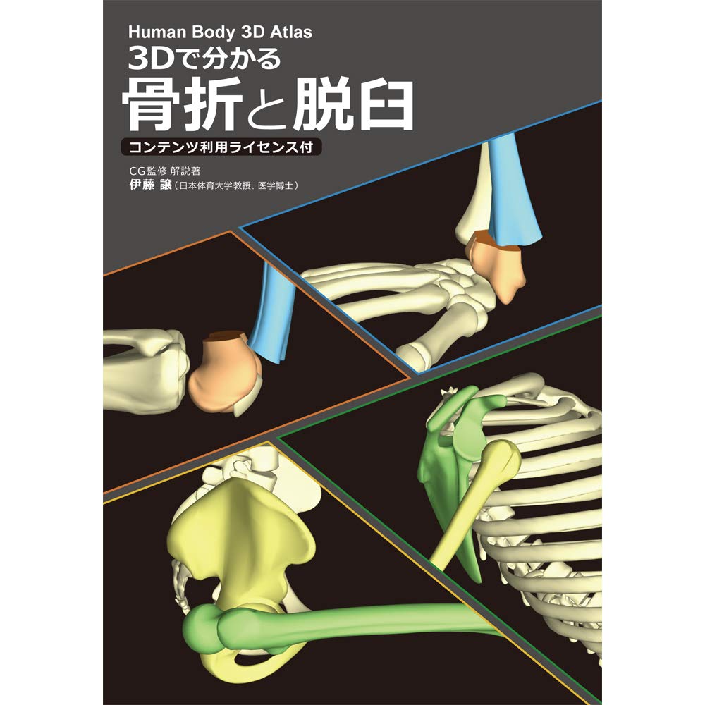 3Dで分かる 骨折と脱臼 コンテンツ利用ライセンス付 | 伊藤 譲 |本