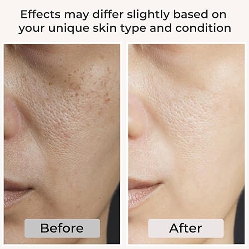 Miniatura 6 de Biaina Organics - Set de cuidado de la piel de leche de cabra  Dúo de leche hidratante equilibrante y tóner curativo  Hidratante facial natural y