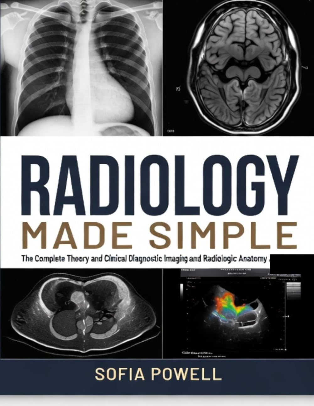 Radiology Made Simple: A Beginner’s Guide to X-Ray, CT & MRI Interpretation for Medical, Nursing & Radiography Students — Learn Fast, Pass Exams, Build Clinical Confidence with Case-Based Practice