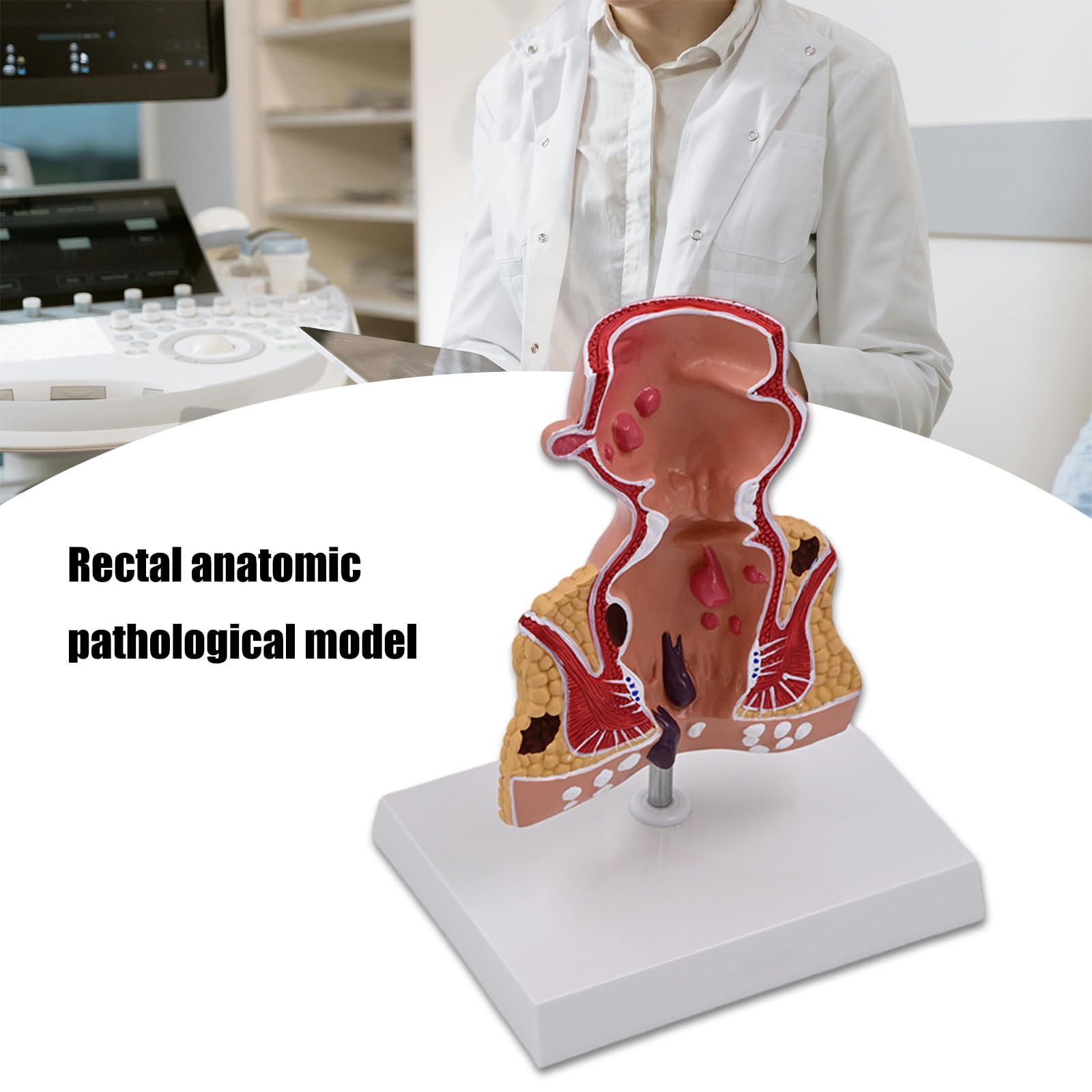 Modello retto per anatomia aiuto didattico patologie umane pratiche del retto modello di materiale scolastico umano per anatomia