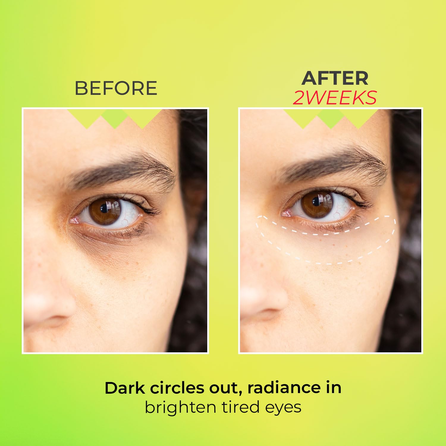 does glutathione lighten eyes Amazon.com: KSBC Look at Me Teen Again Dark Circle Eye Cream, Anti-Aging  Line Smoothing Skin Care Treatment, Wrinkle Care, Cruelty Free, for Women  and Men 0.84 fl. oz 25 ml : Beauty